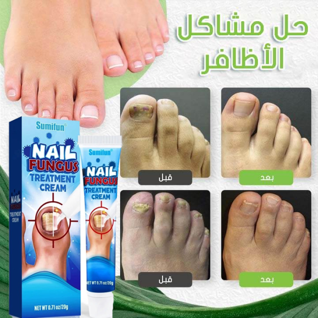 مرهم علاج فطريات الاضافر